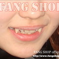 写真: FANG SHOP 付け牙 N-0077