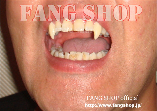 FANG SHOP 付け牙 N-0100